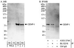 Detection of human CENP-I by western blot and immunoprecipitation.