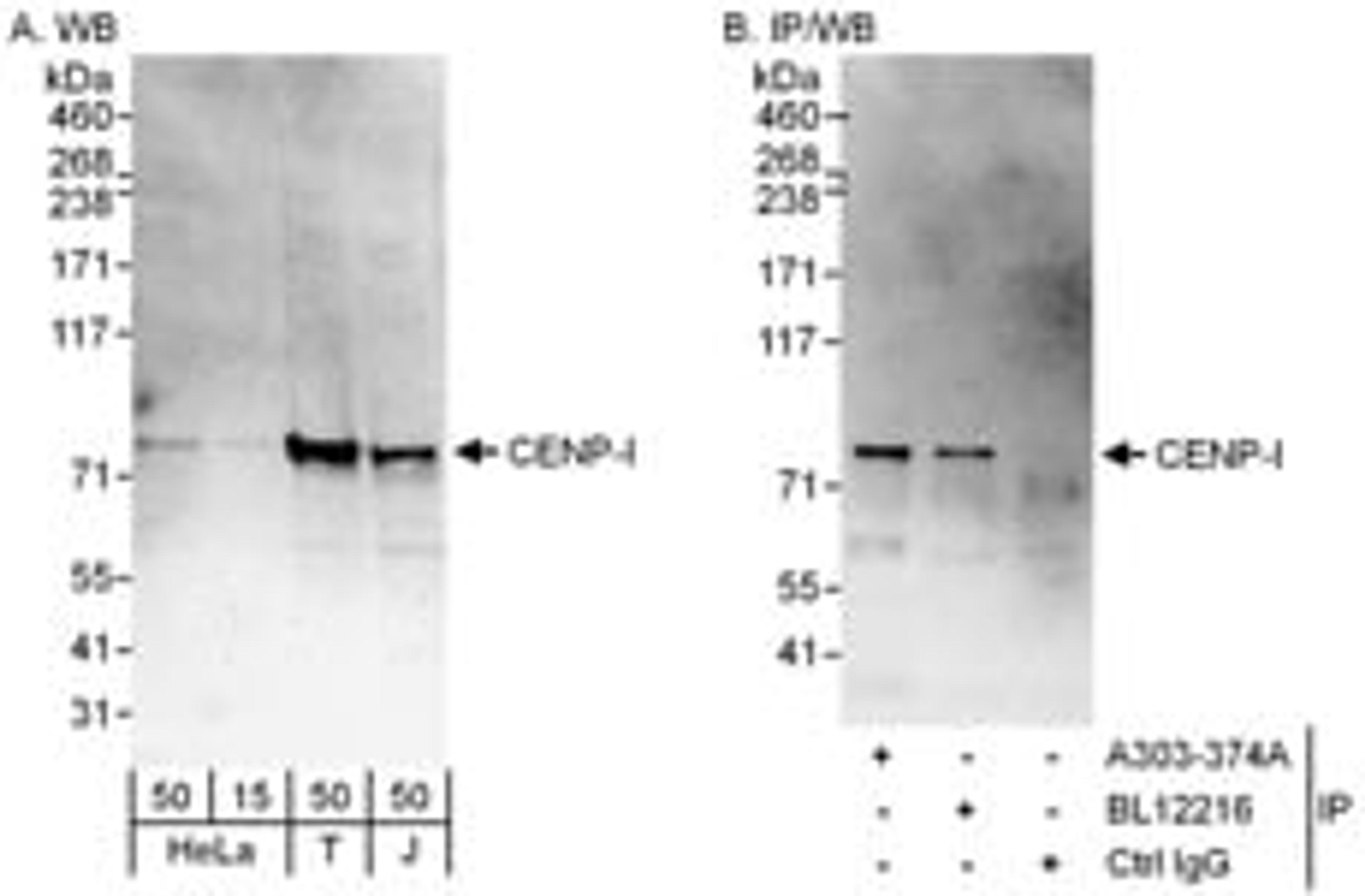 Detection of human CENP-I by western blot and immunoprecipitation.