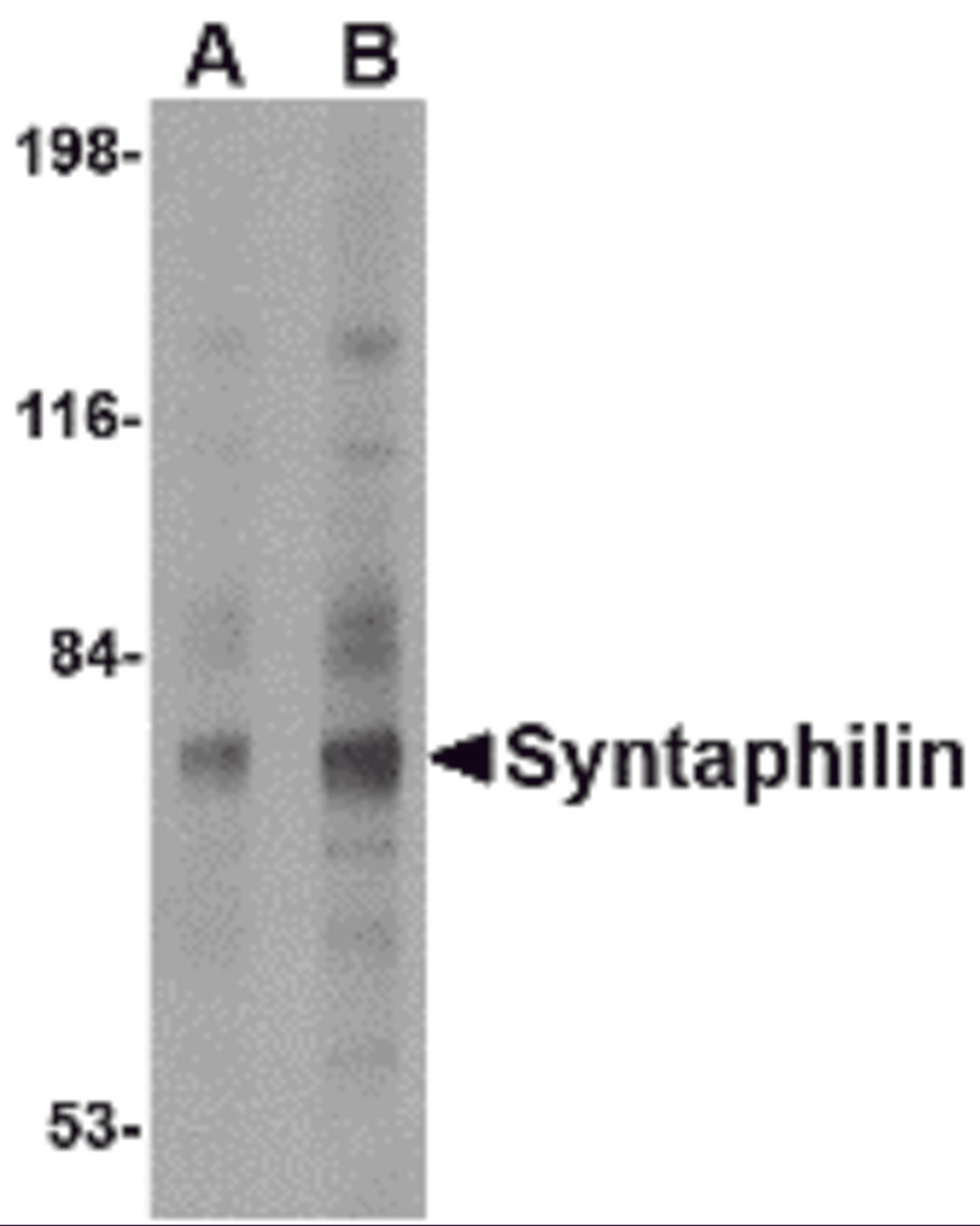 Western blot analysis of Syntaphilin in human brain tissue lysate with Syntaphilin antibody at (A) 2 and (B) 4 &#956;g/mL.