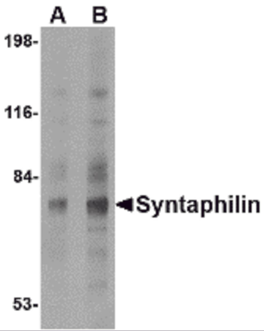 Western blot analysis of Syntaphilin in human brain tissue lysate with Syntaphilin antibody at (A) 2 and (B) 4 μg/mL.