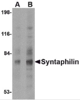 Western blot analysis of Syntaphilin in human brain tissue lysate with Syntaphilin antibody at (A) 2 and (B) 4 μg/mL.