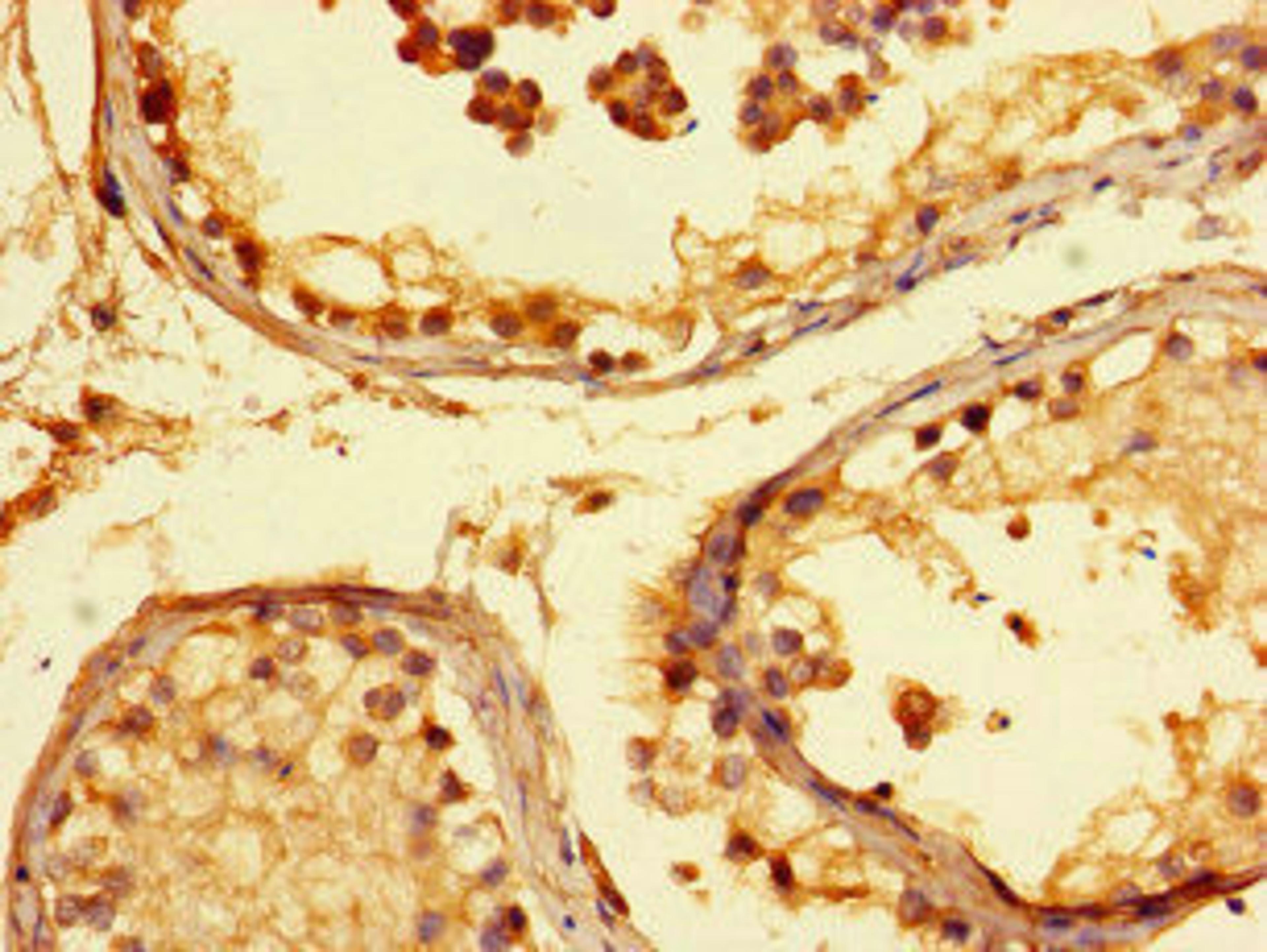 Immunohistochemistry of paraffin-embedded human testis tissue using CSB-PA770344LA01HU at dilution of 1:100