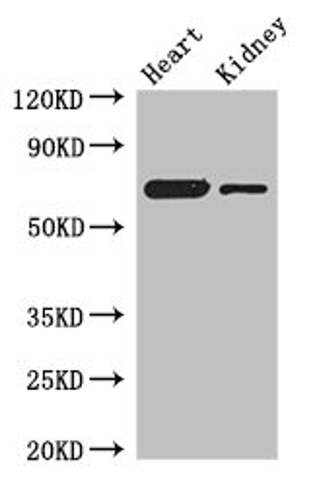 Western Blot. Positive WB detected in: Mouse heart tissue, Mouse kidney tissue. All lanes: ETFDH antibody at 3µg/ml. Secondary. Goat polyclonal to rabbit IgG at 1/50000 dilution. Predicted band size: 69, 63 kDa. Observed band size: 69 kDa