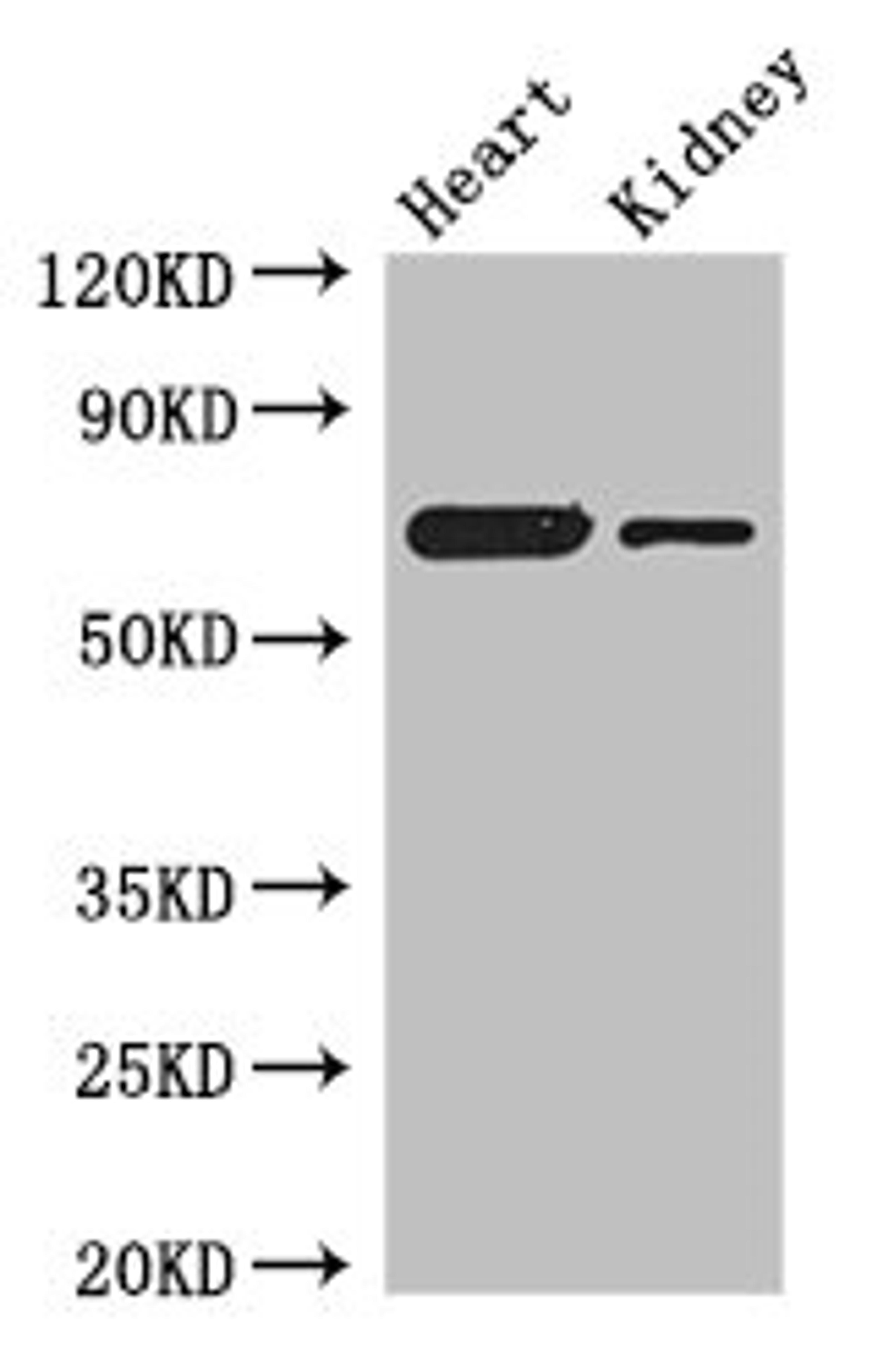 Western Blot. Positive WB detected in: Mouse heart tissue, Mouse kidney tissue. All lanes: ETFDH antibody at 3µg/ml. Secondary. Goat polyclonal to rabbit IgG at 1/50000 dilution. Predicted band size: 69, 63 kDa. Observed band size: 69 kDa