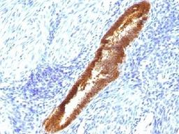 IHC testing of FFPE human endometrium with ASRGL1 antibody (clone CRASH/1289). Required HIER: steam sections in 10mM Tris with 1mM EDTA, pH9, for 10-20 min.