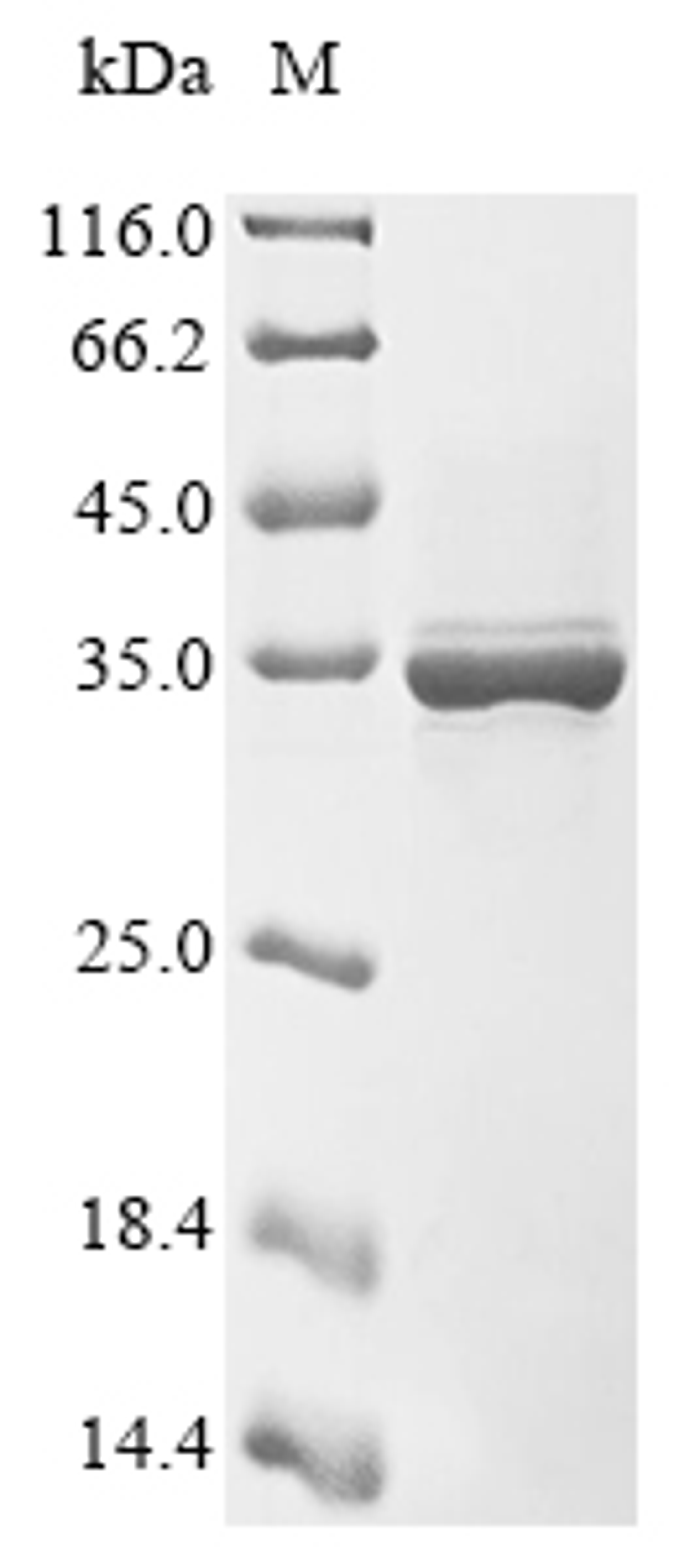 (Tris-Glycine gel) Discontinuous SDS-PAGE (reduced) with 5% enrichment gel and 15% separation gel.