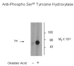 Western Blot: Tyrosine Hydroxylase [p Ser31] Antibody [NB300-211] - PC-12 cells incubated in the absence (Control) and presence of okadaic acid (OA, 1 uM for 60 min) showing specific immunolabeling of the ~60k TH phosphorylated at Ser31.