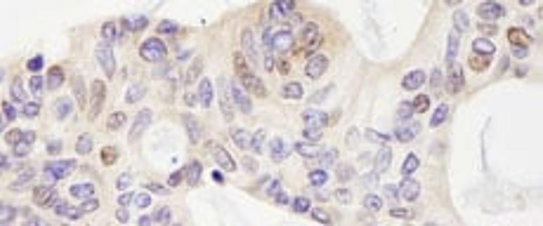 Detection of human USP28 by immunohistochemistry.