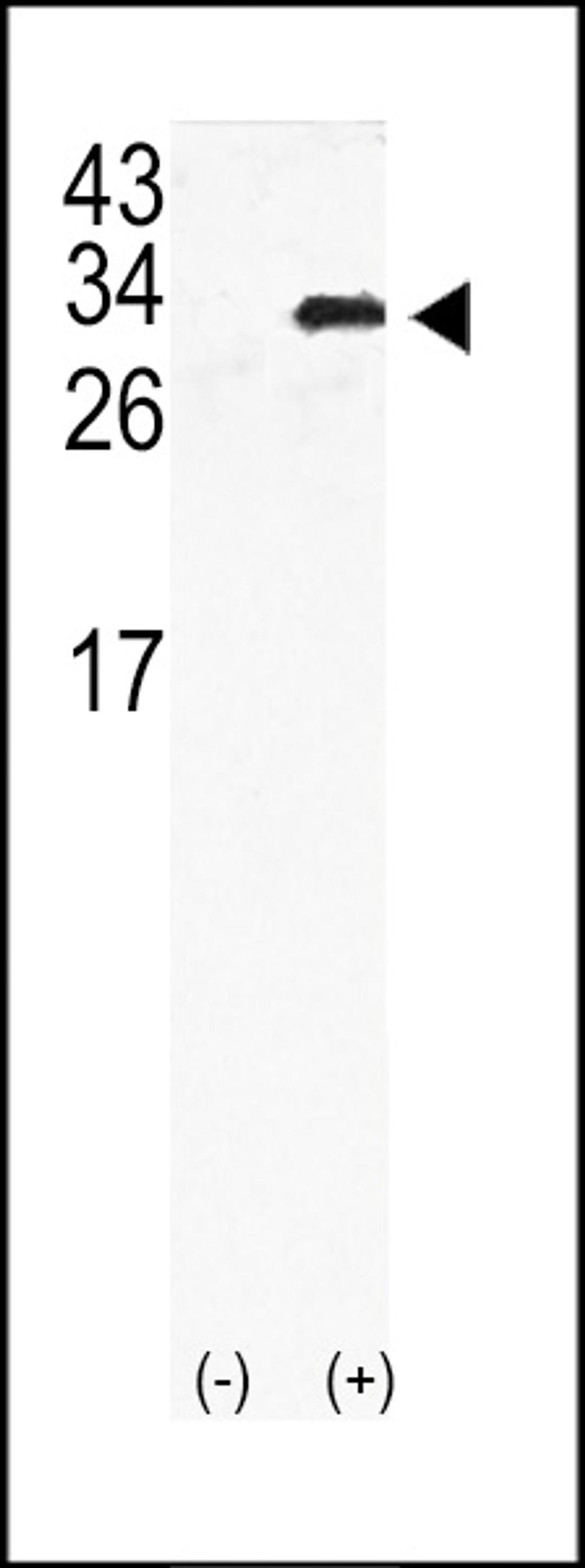 Western blot analysis of GJB6 using rabbit polyclonal GJB6 Antibody using 293 cell lysates (2 ug/lane) either nontransfected (Lane 1) or transiently transfected with the GJB6gene (Lane 2).