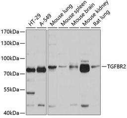 Western blot - TGFBR2 antibody (A1415)