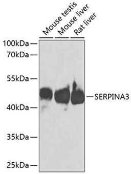 Western blot - SERPINA3 antibody (A1021)