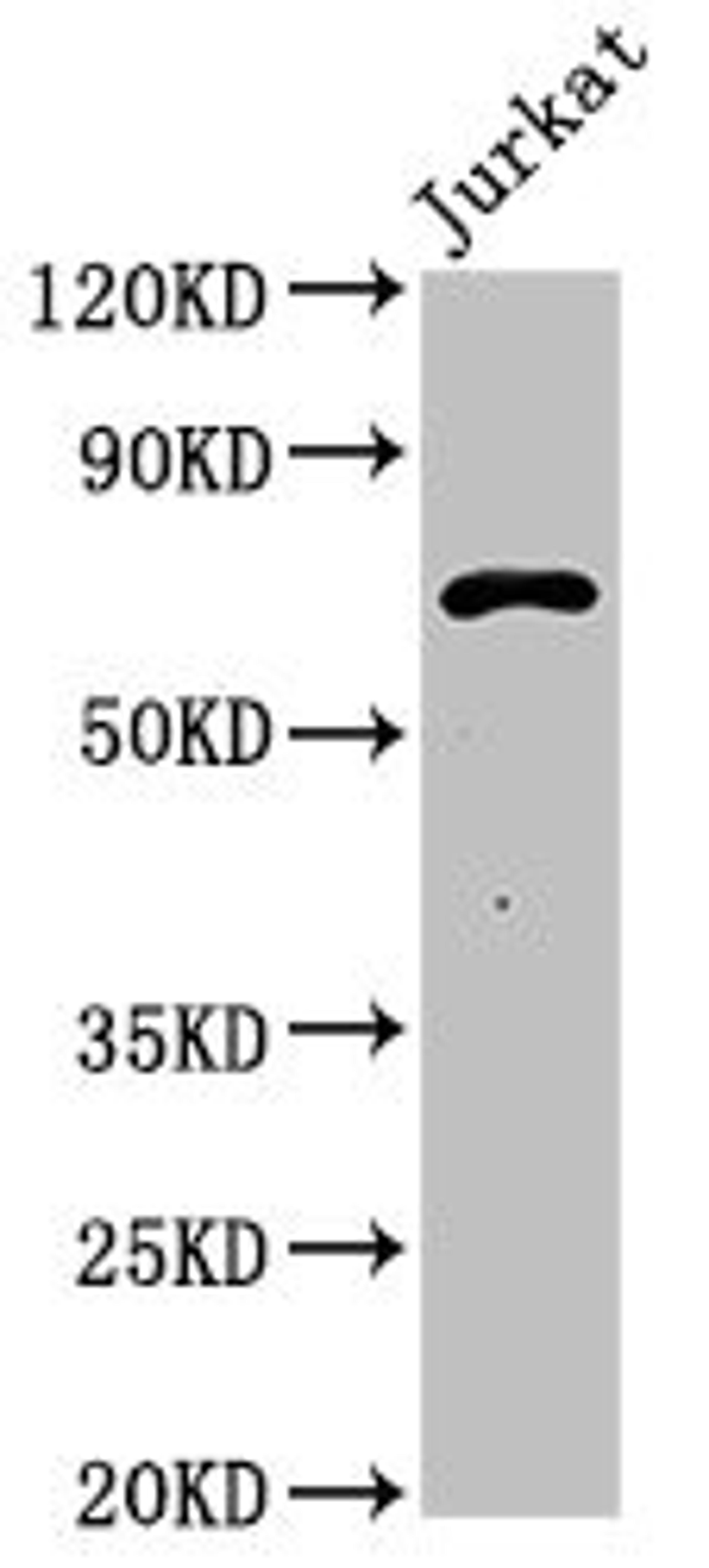 Western Blot. Positive WB detected in: Jurkat whole cell lysate. All lanes: Pcsk1 antibody at 3ug/ml. Secondary. Goat polyclonal to rabbit IgG at 1/50000 dilution. Predicted band size: 71 kDa. Observed band size: 71 kDa. 