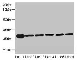 Western blot. All lanes: TMED9 antibody at 4.5µg/ml. Lane 1: Mouse liver tissue. Lane 2: Mouse kidney tissue. Lane 3: Human placenta tissue. Lane 4: A549 whole cell lysate. Lane 5: MCF-7 whole cell lysate. Lane 6: A431 whole cell lysate. Secondary. Goat polyclonal to rabbit IgG at 1/10000 dilution. Predicted band size: 28 kDa. Observed band size: 28 kDa