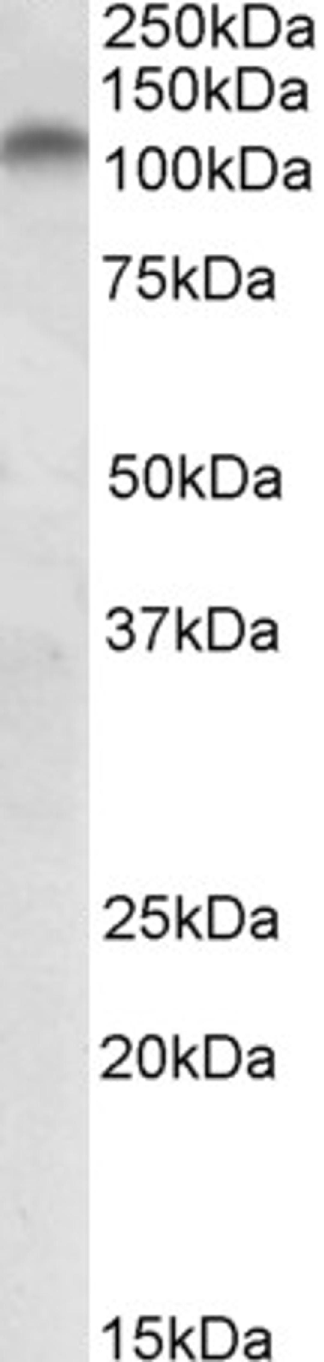 46-331 (2ug/ml) staining of Human Colon lysate (35ug protein in RIPA buffer). Primary incubation was 1 hour. Detected by chemiluminescence.