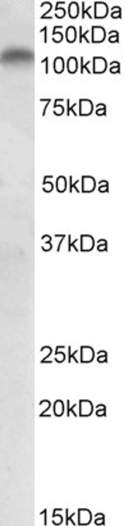 46-331 (2ug/ml) staining of Human Colon lysate (35ug protein in RIPA buffer). Primary incubation was 1 hour. Detected by chemiluminescence.