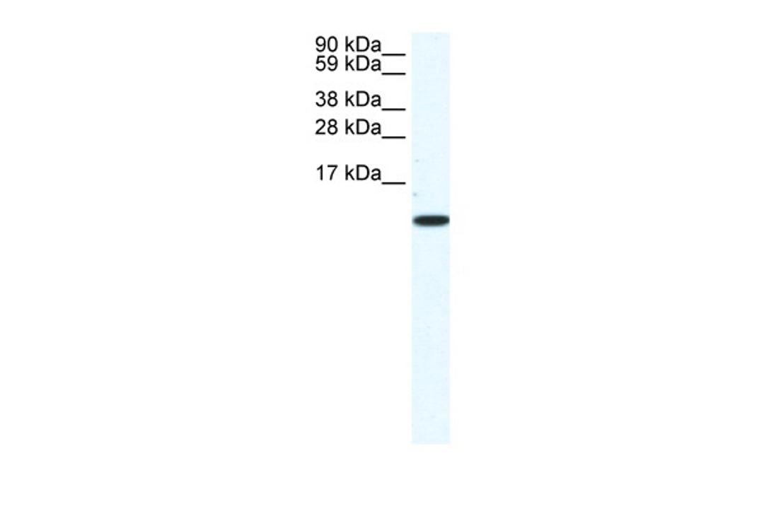 Antibody used in WB on Mouse NIH-3T3 at 1.25 ug/ml.