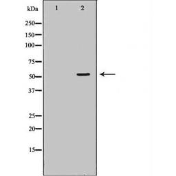 Western blot analysis of various cell lines using pan-AKT antibody