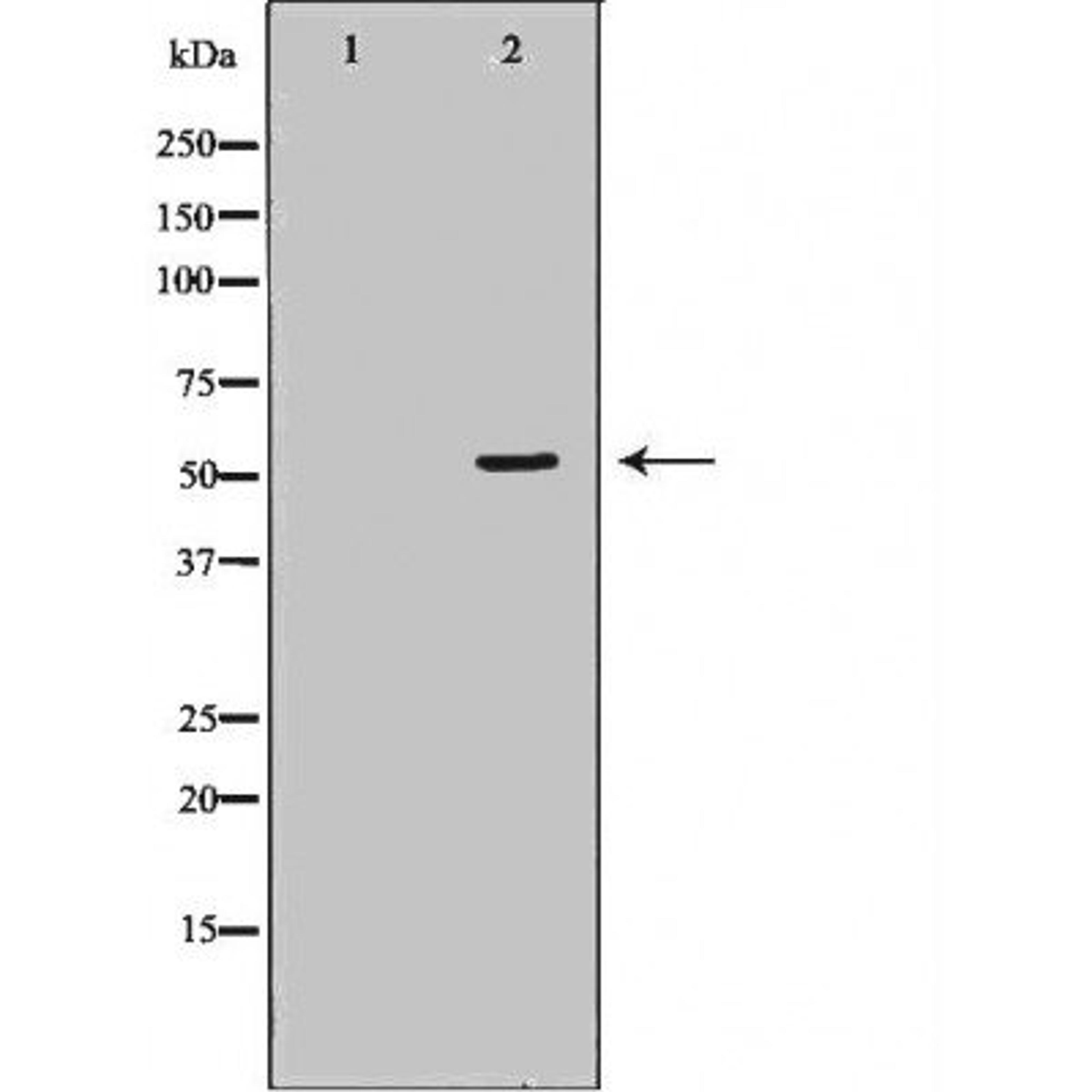 Western blot analysis of various cell lines using pan-AKT antibody