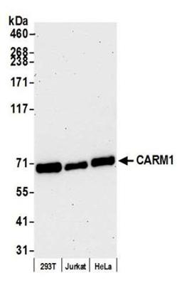 Detection of human CARM1 by western blot.