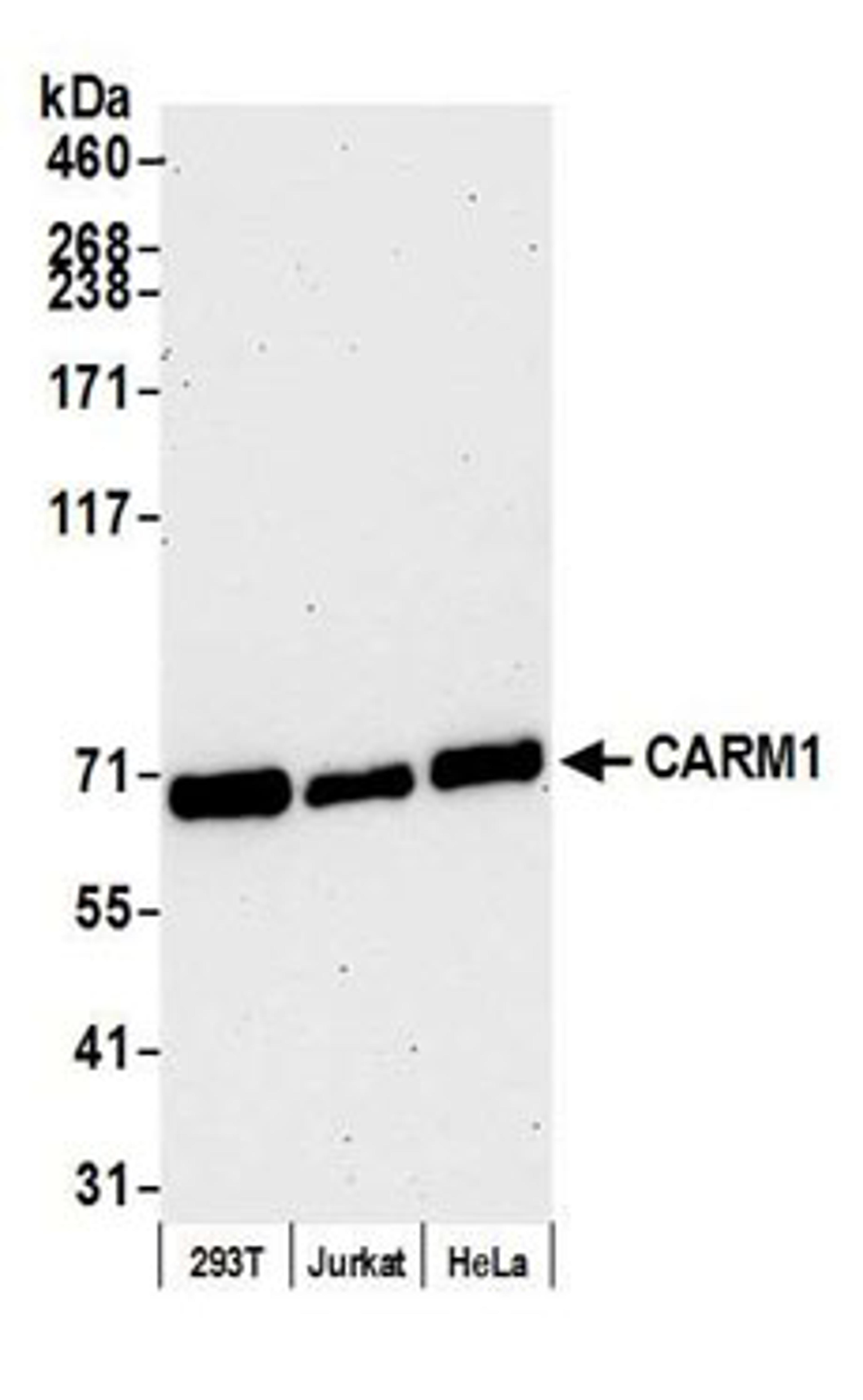 Detection of human CARM1 by western blot.