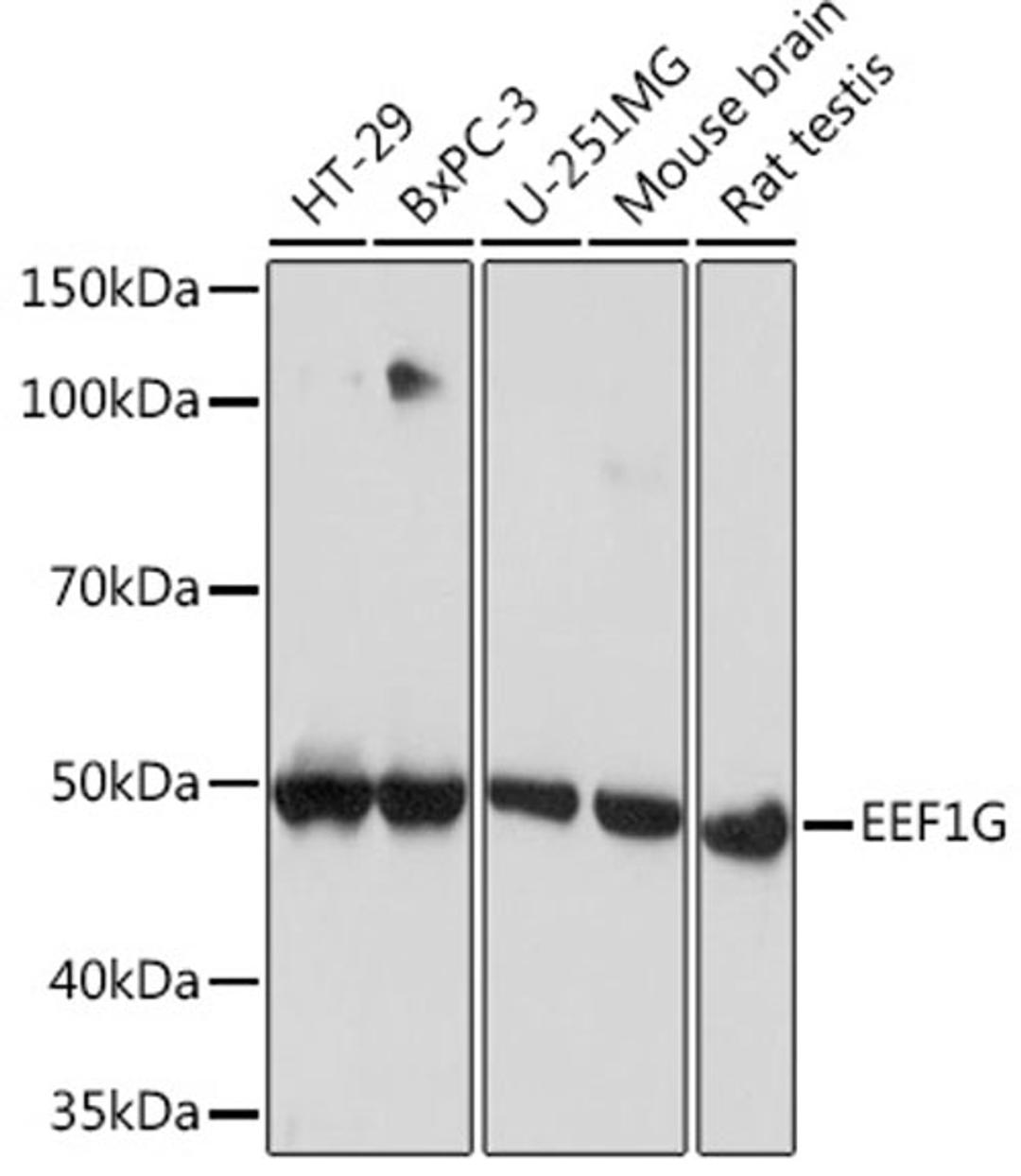 Western blot - EEF1G Rabbit mAb (A8744)