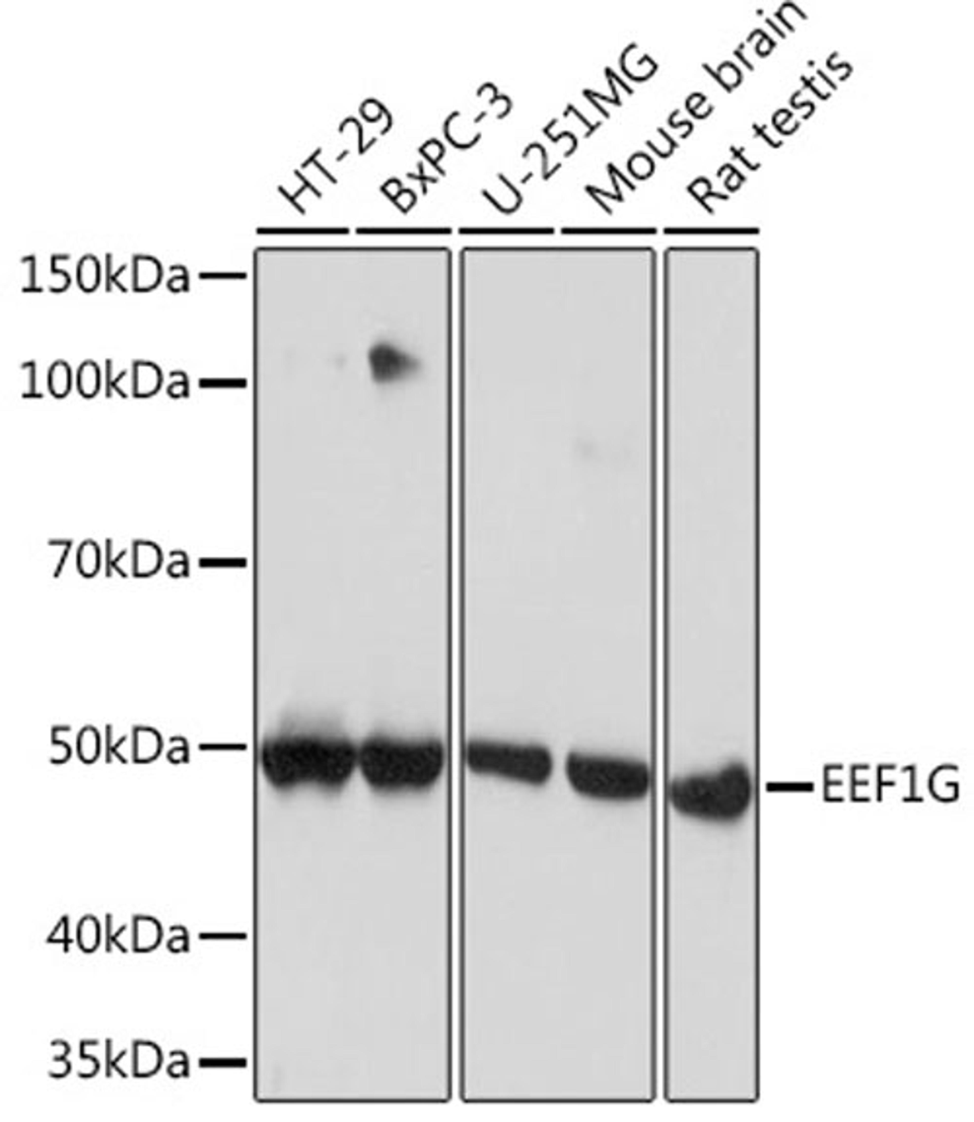 Western blot - EEF1G Rabbit mAb (A8744)