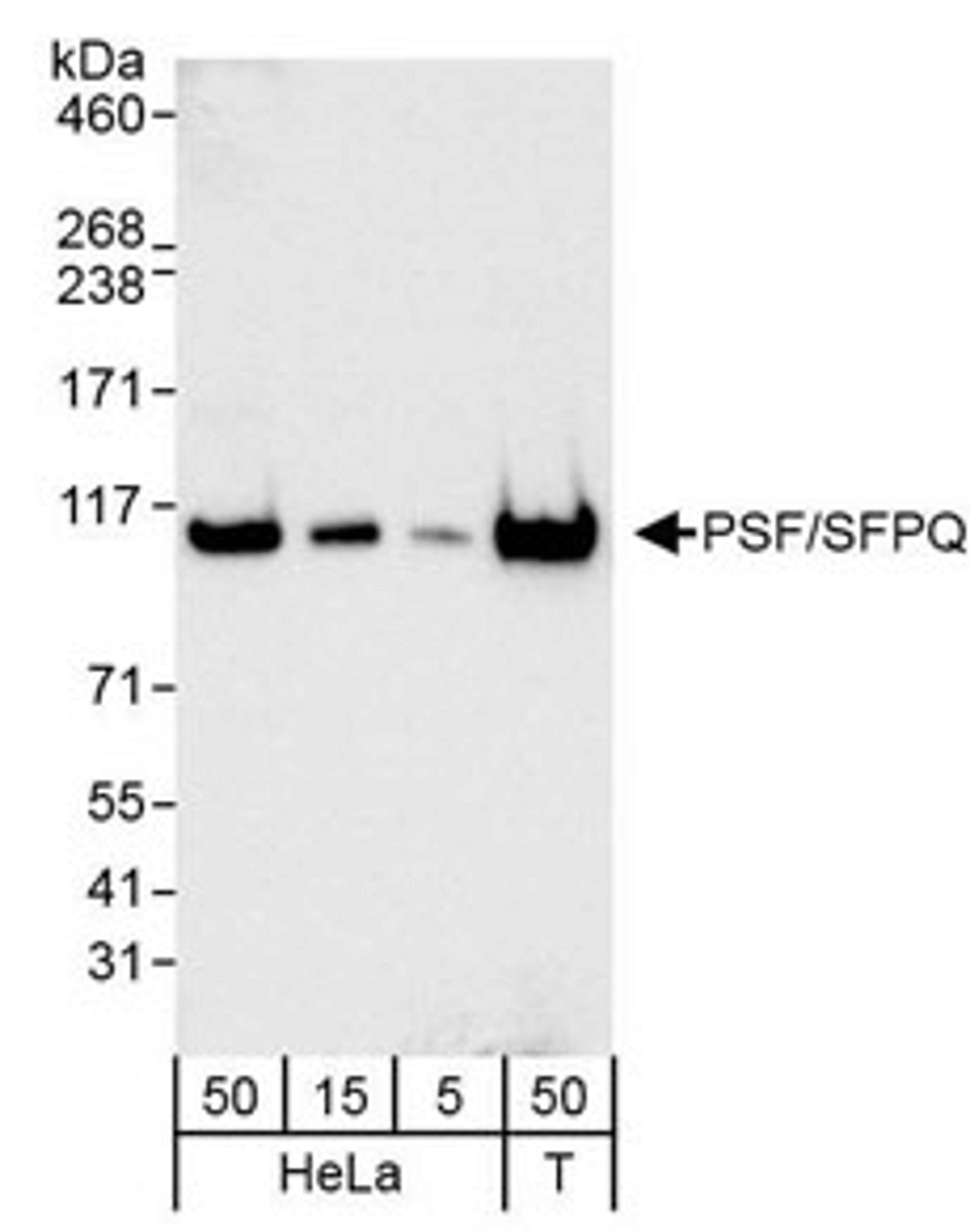 Detection of human PSF/SFPQ by western blot.