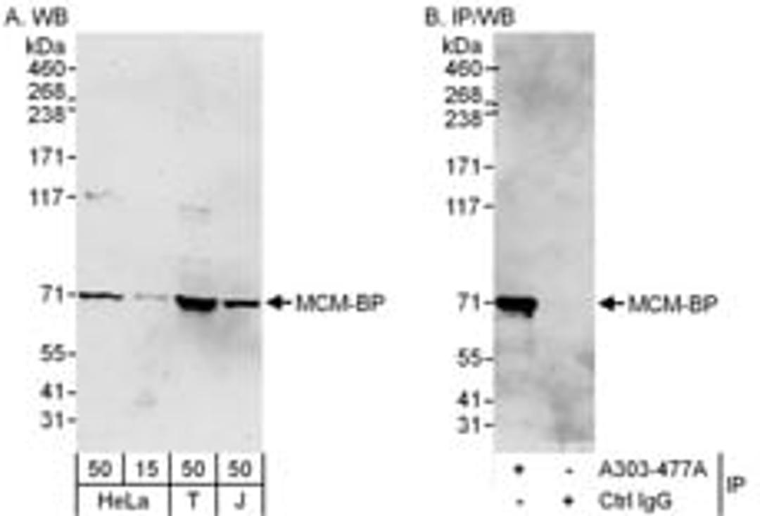 Detection of human MCM-BP by western blot and immunoprecipitation.