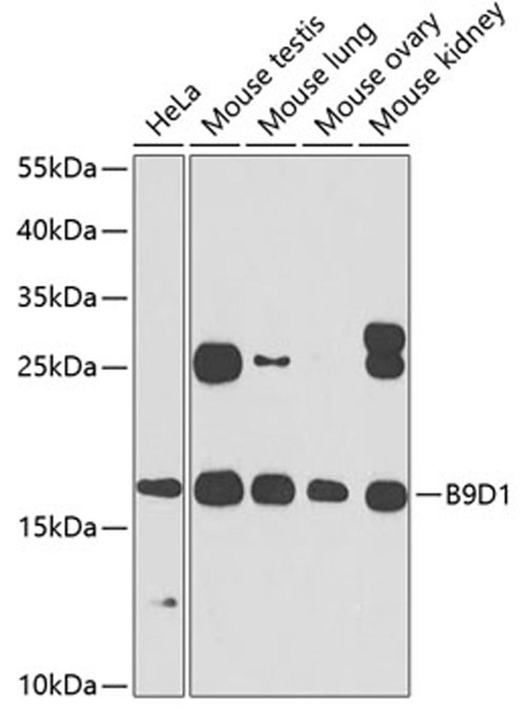 Western blot - B9D1 antibody (A7973)