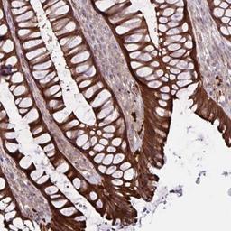 Immunohistochemistry: GLTP Antibody [NBP2-31642] - Staining of human rectum shows strong cytoplasmic and membranous positivity in glandular cells.