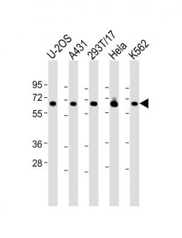 Western Blot at 1:2000 dilution Lane 1: U-2OS whole cell lysate Lane 2: A431 whole cell lysate Lane 3: 293T/17 whole cell lysate Lane 4: Hela whole cell lysate Lane 5: K562 whole cell lysate Lysates/proteins at 20 ug per lane.