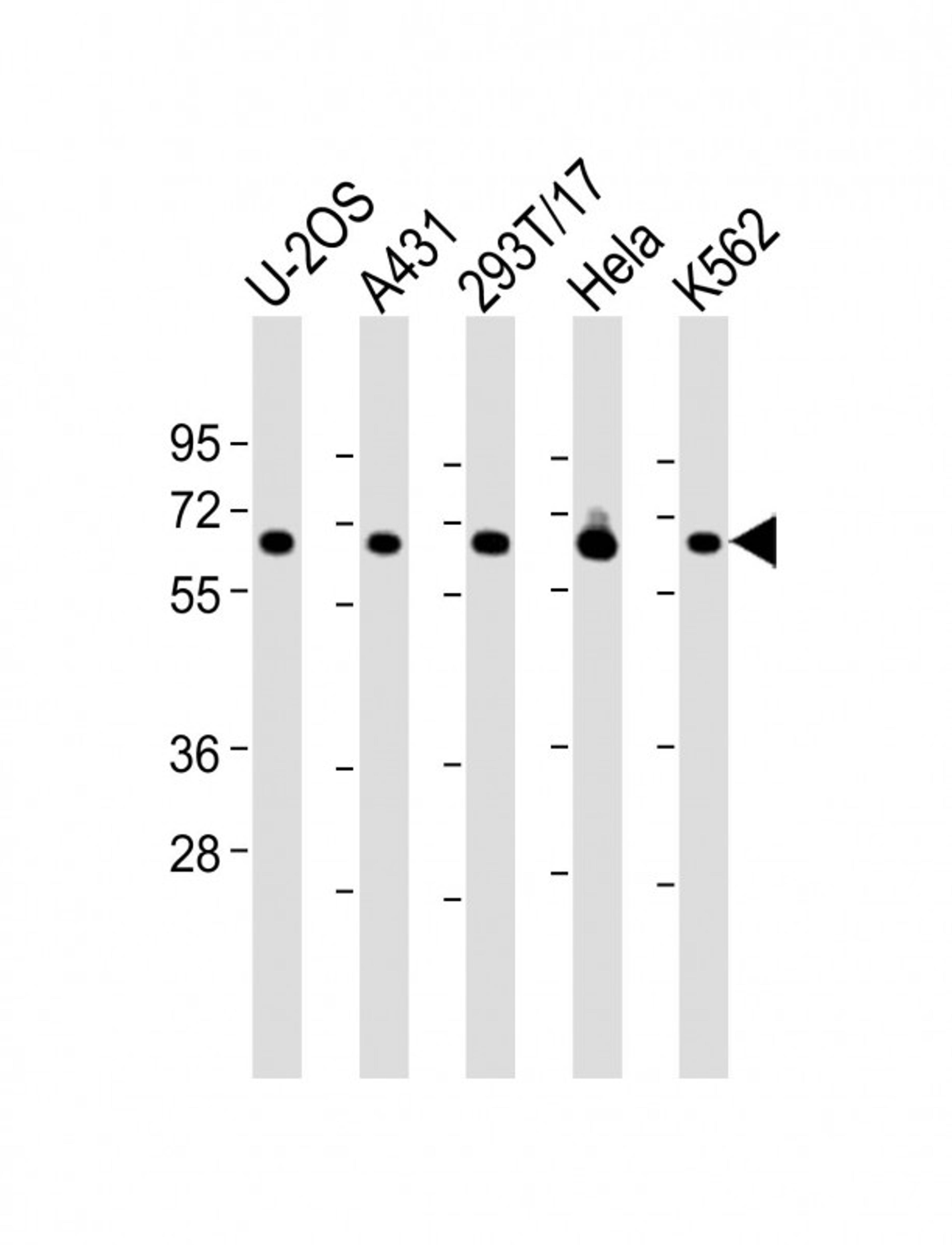 Western Blot at 1:2000 dilution Lane 1: U-2OS whole cell lysate Lane 2: A431 whole cell lysate Lane 3: 293T/17 whole cell lysate Lane 4: Hela whole cell lysate Lane 5: K562 whole cell lysate Lysates/proteins at 20 ug per lane.