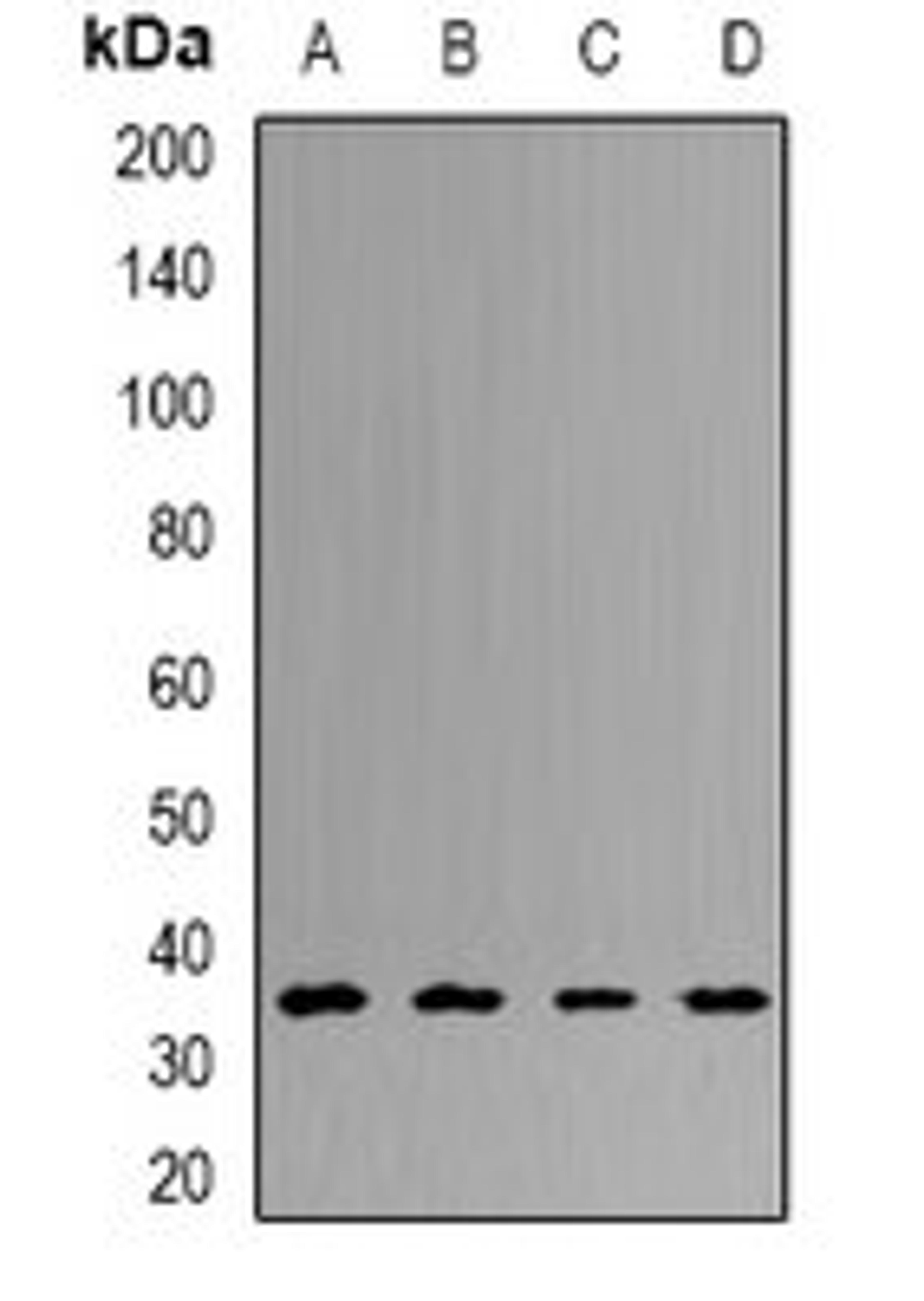 Western blot analysis of HT29 (Lane1), Hela (Lane2), mouse liver (Lane3), rat brain (Lane4) whole cell lysates using UCHL5 antibody