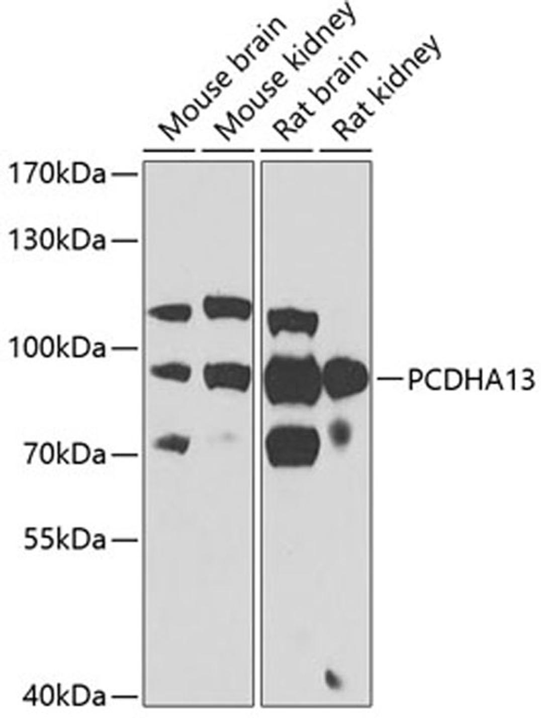 Western blot - PCDHA13 antibody (A7475)