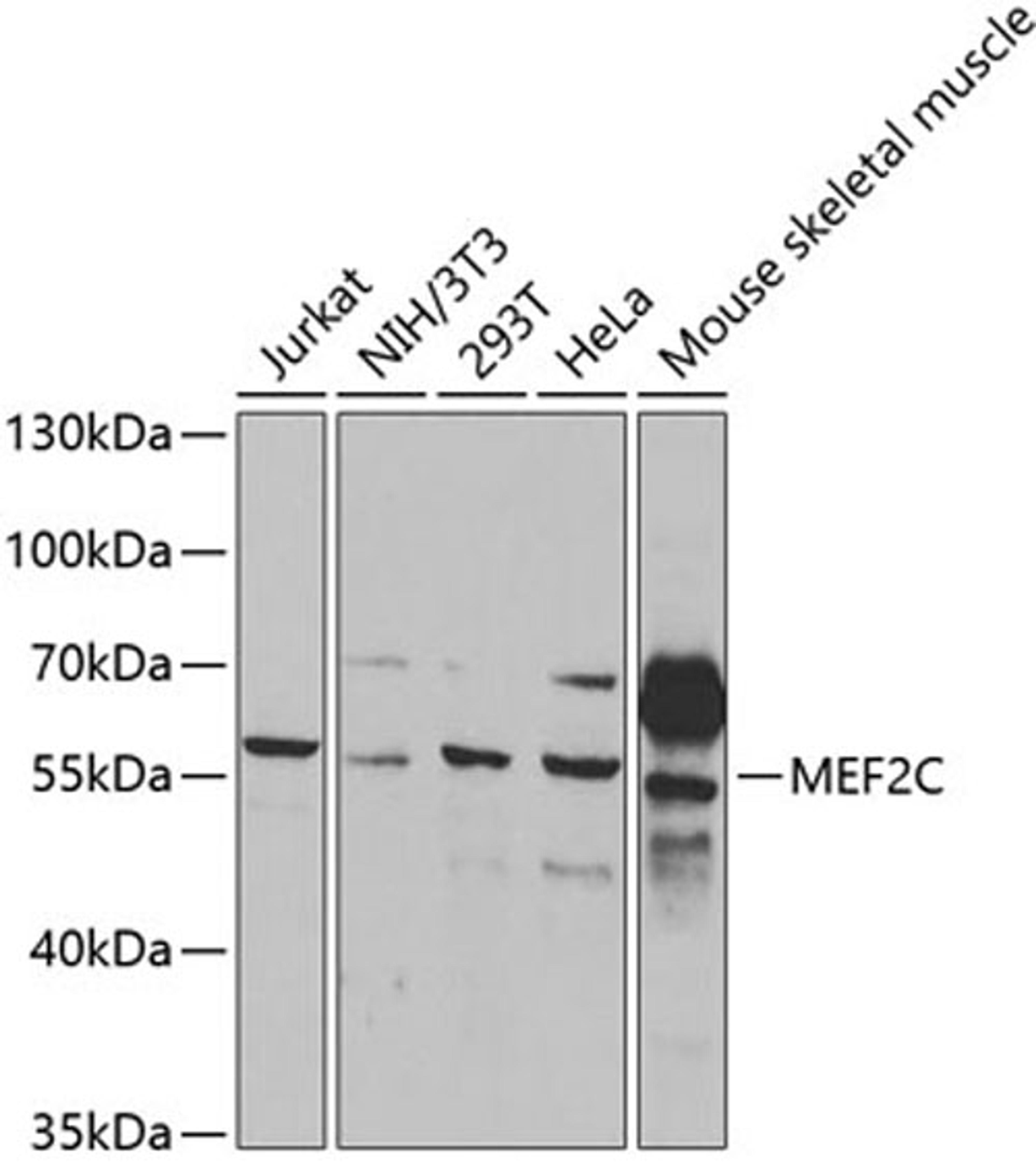 Western blot - MEF2C antibody (A2585)