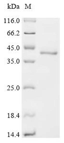 (Tris-Glycine gel) Discontinuous SDS-PAGE (reduced) with 5% enrichment gel and 15% separation gel.
