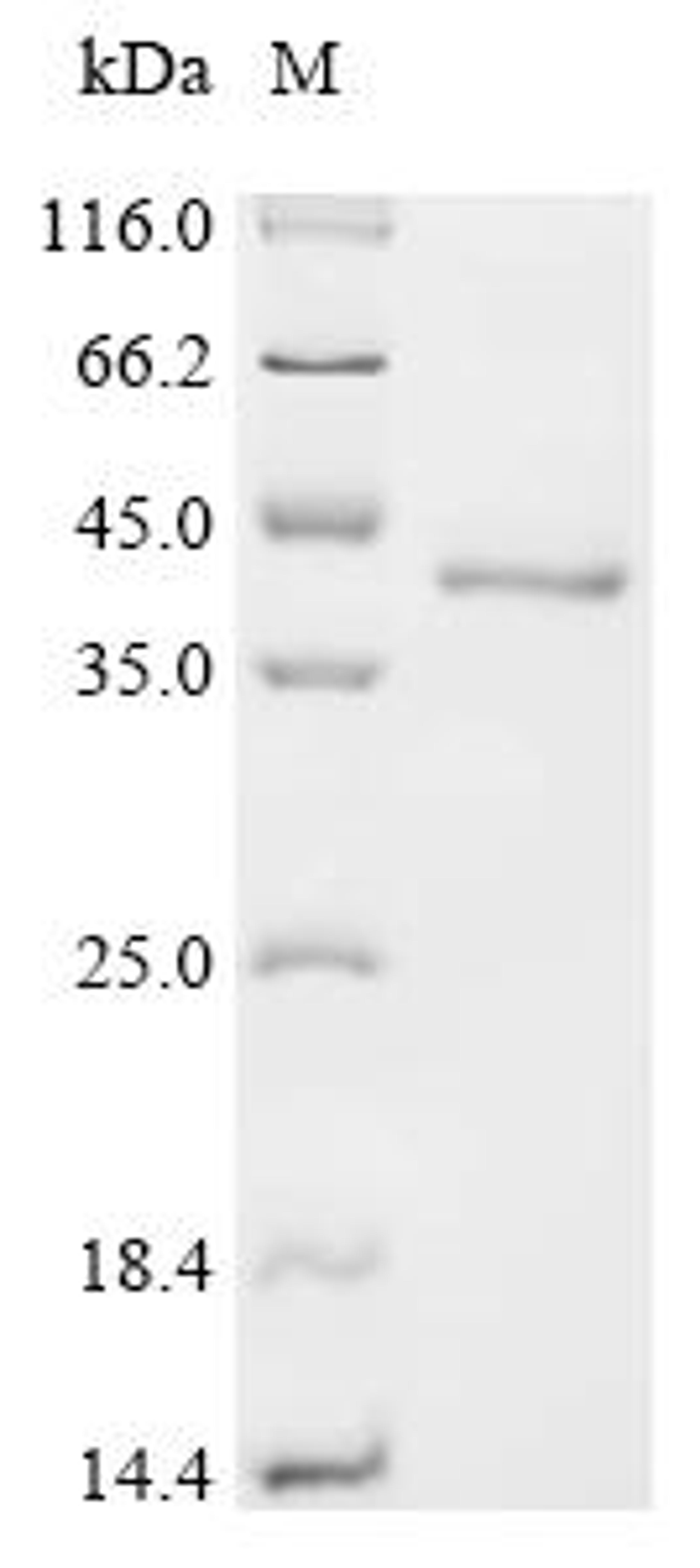 (Tris-Glycine gel) Discontinuous SDS-PAGE (reduced) with 5% enrichment gel and 15% separation gel.
