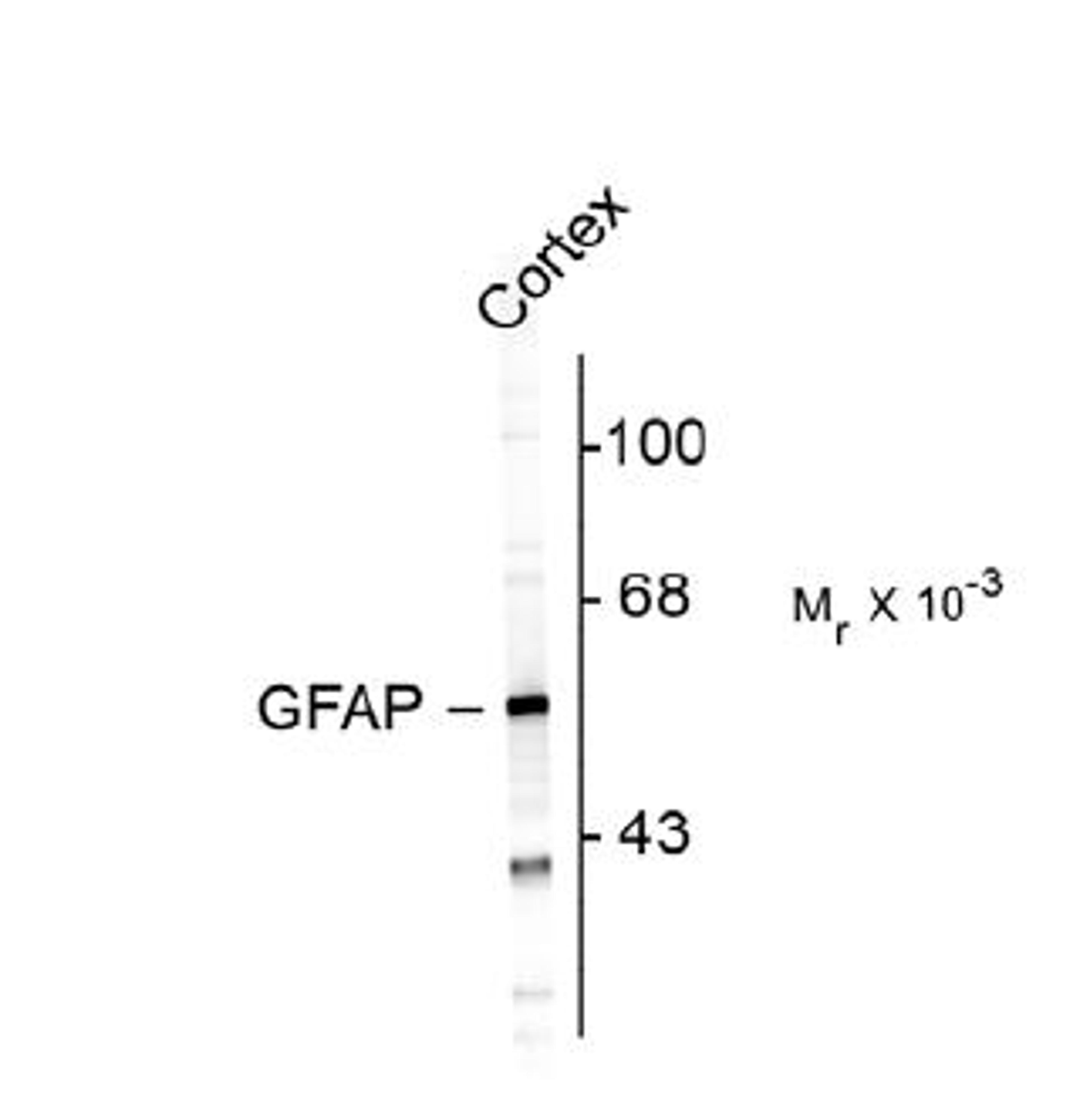 Western blot of rat cortex lysate showing specific immunolabeling of the ~ 50k GFAP protein. <br><br> <b>Below:</b> Mixed cultures of neurons and glia stained with chicken anti-GFAP (red), and DNA (blue). Astrocytes stain strongly and specifically in a cl