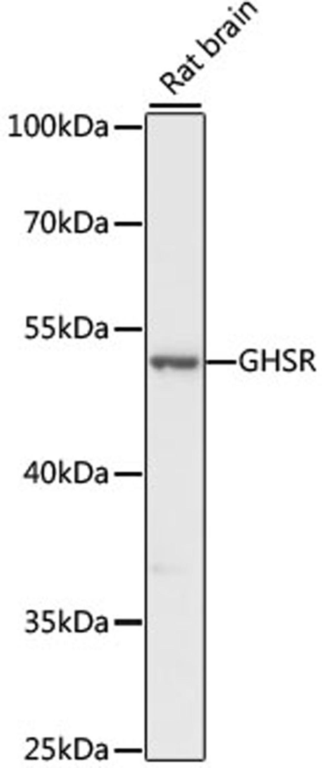 Western blot - GHSR antibody (A1840)