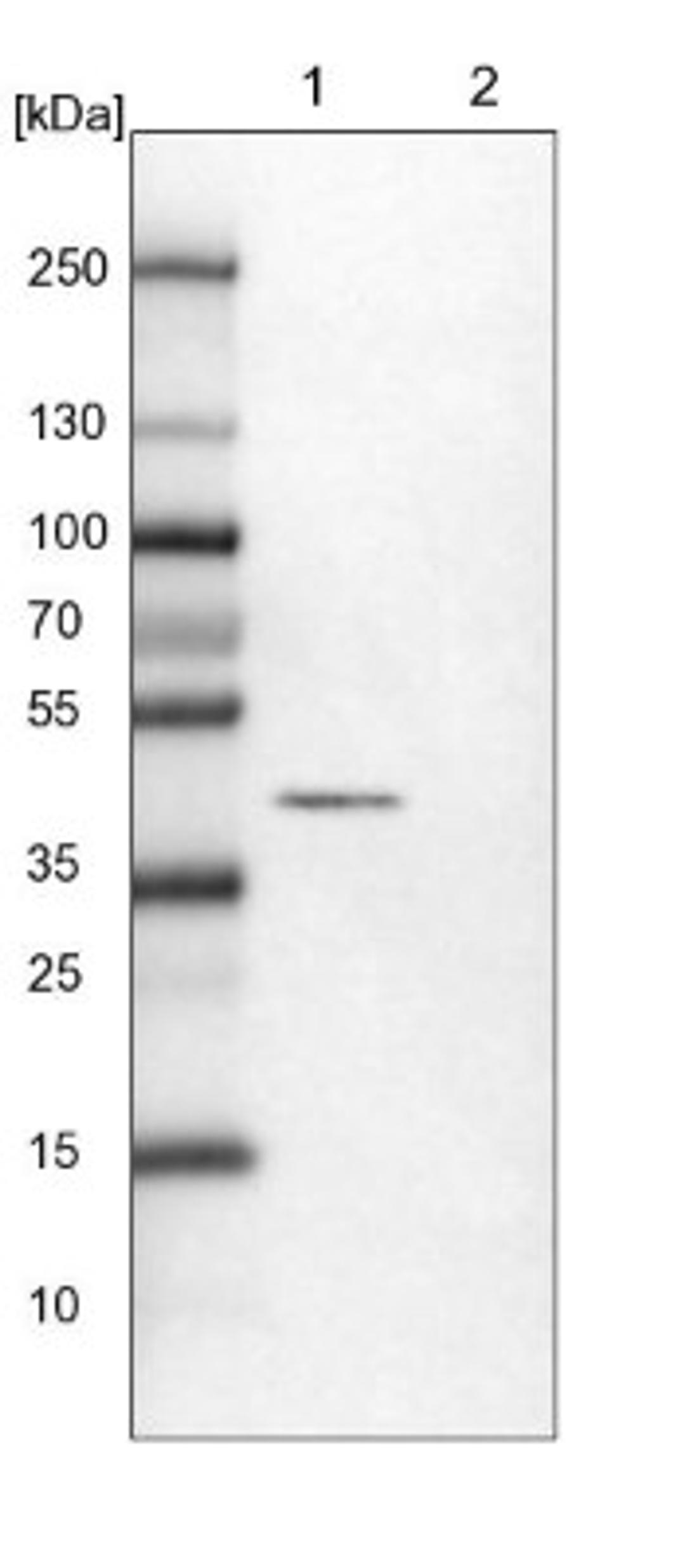 Western Blot: RCN1 Antibody [NBP1-83483] - Lane 1: NIH-3T3 cell lysate (Mouse embryonic fibroblast cells)<br/>Lane 2: NBT-II cell lysate (Rat Wistar bladder tumour cells)