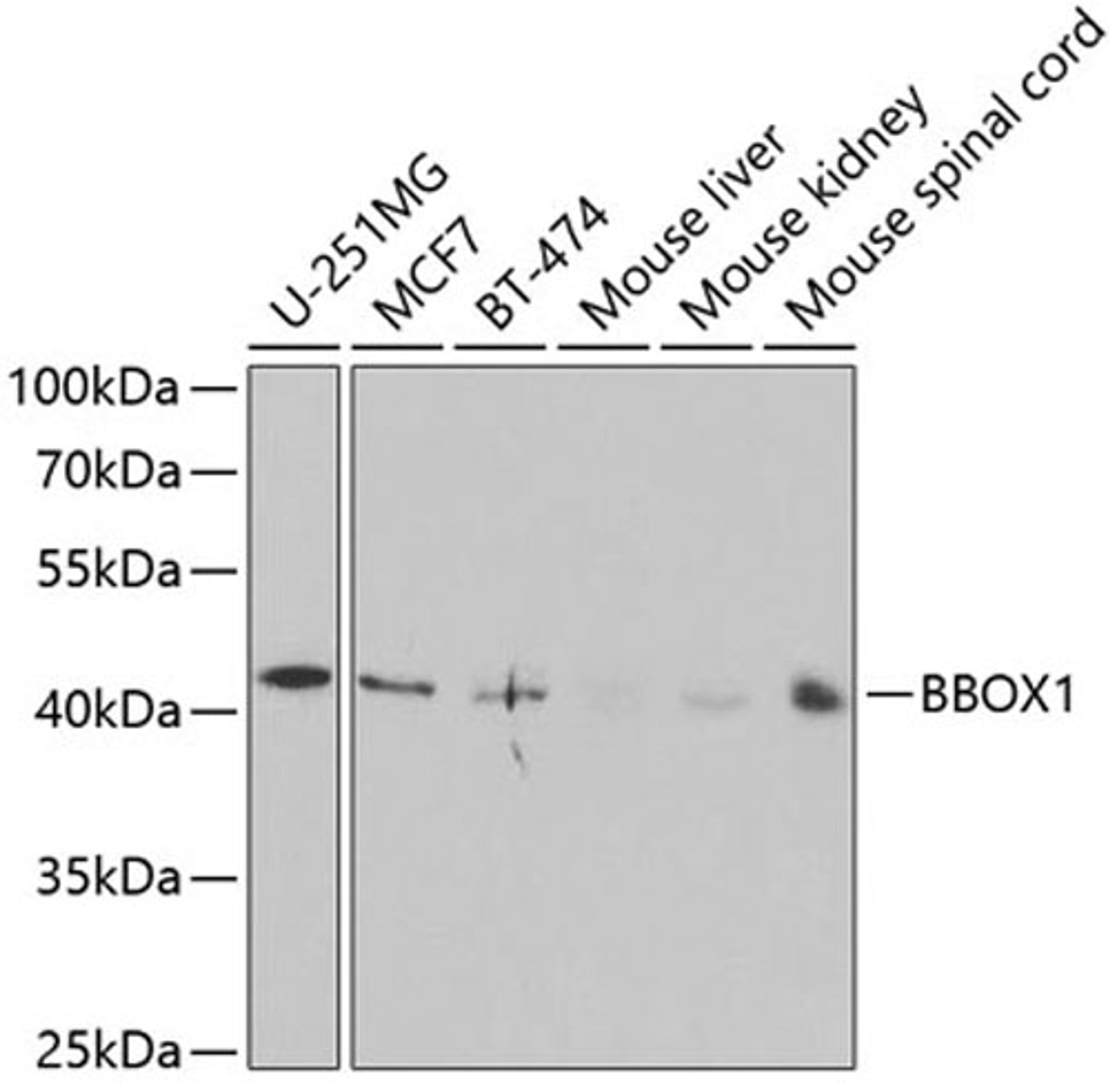 Western blot - BBOX1 antibody (A5810)