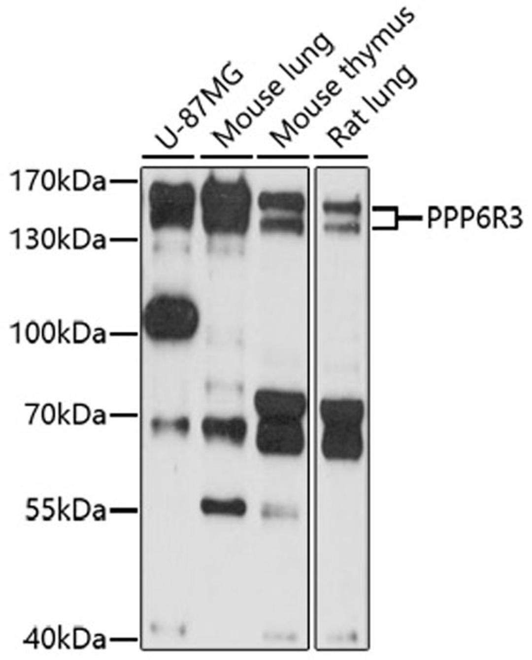 Western blot - PPP6R3 antibody (A17177)