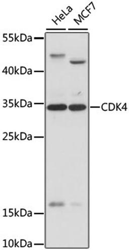 Western blot - CDK4 antibody (A0366)