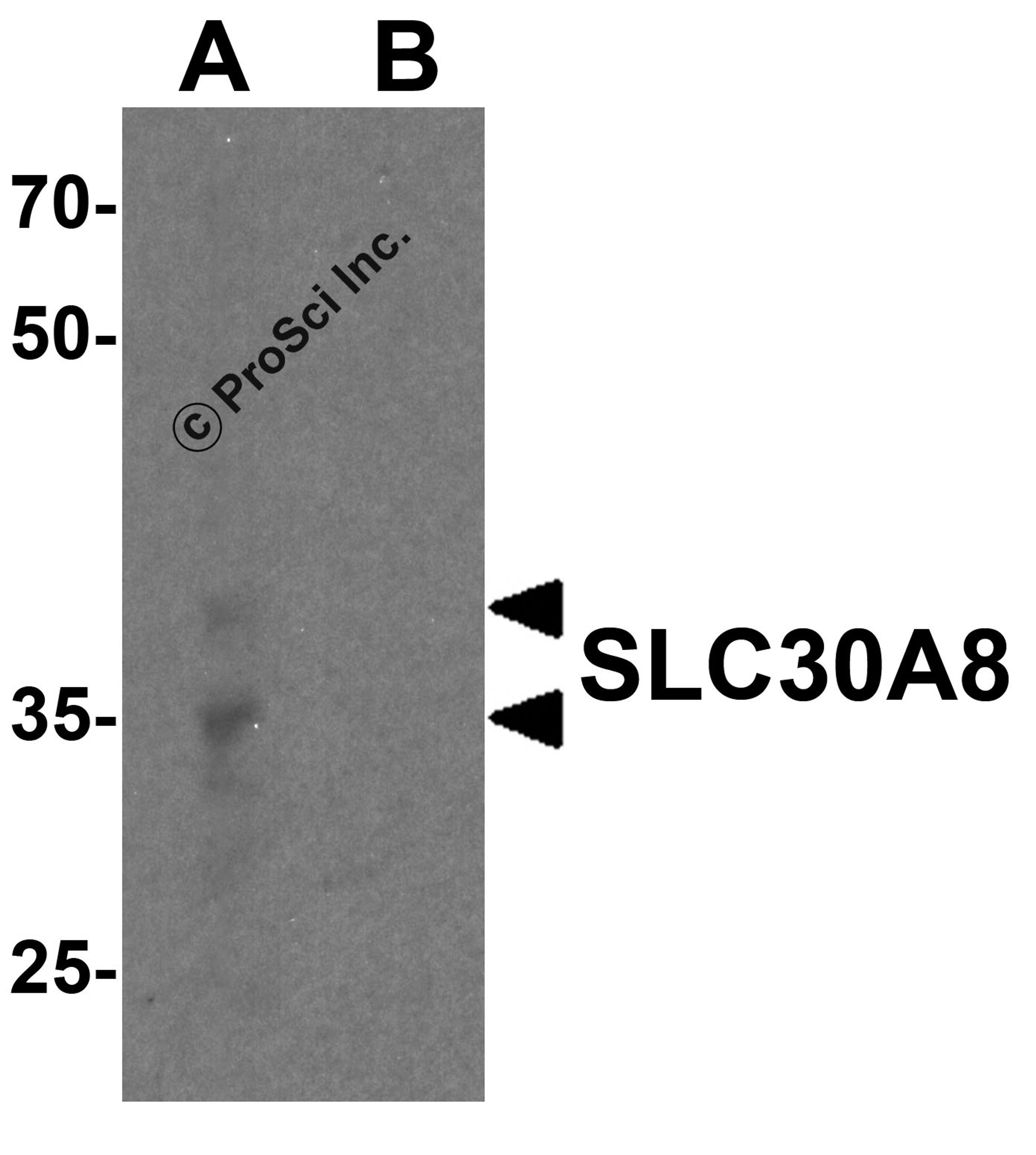 Western blot analysis of SLC30A8 in human pancreas tissue lysate with SLC30A8 antibody at 1 μg/ml in (A) the absence and (B) the presence of blocking peptide