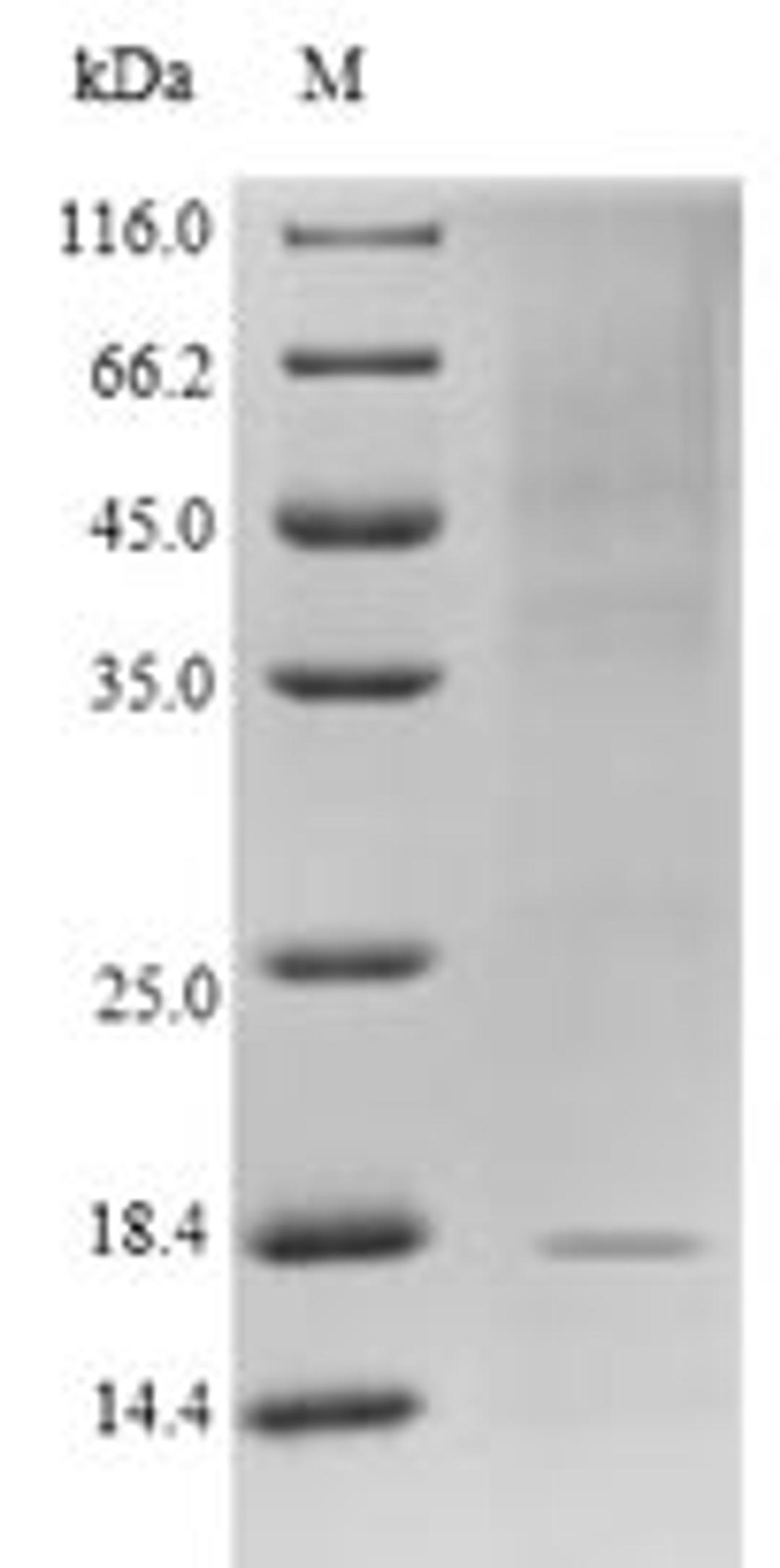 (Tris-Glycine gel) Discontinuous SDS-PAGE (reduced) with 5% enrichment gel and 15% separation gel.