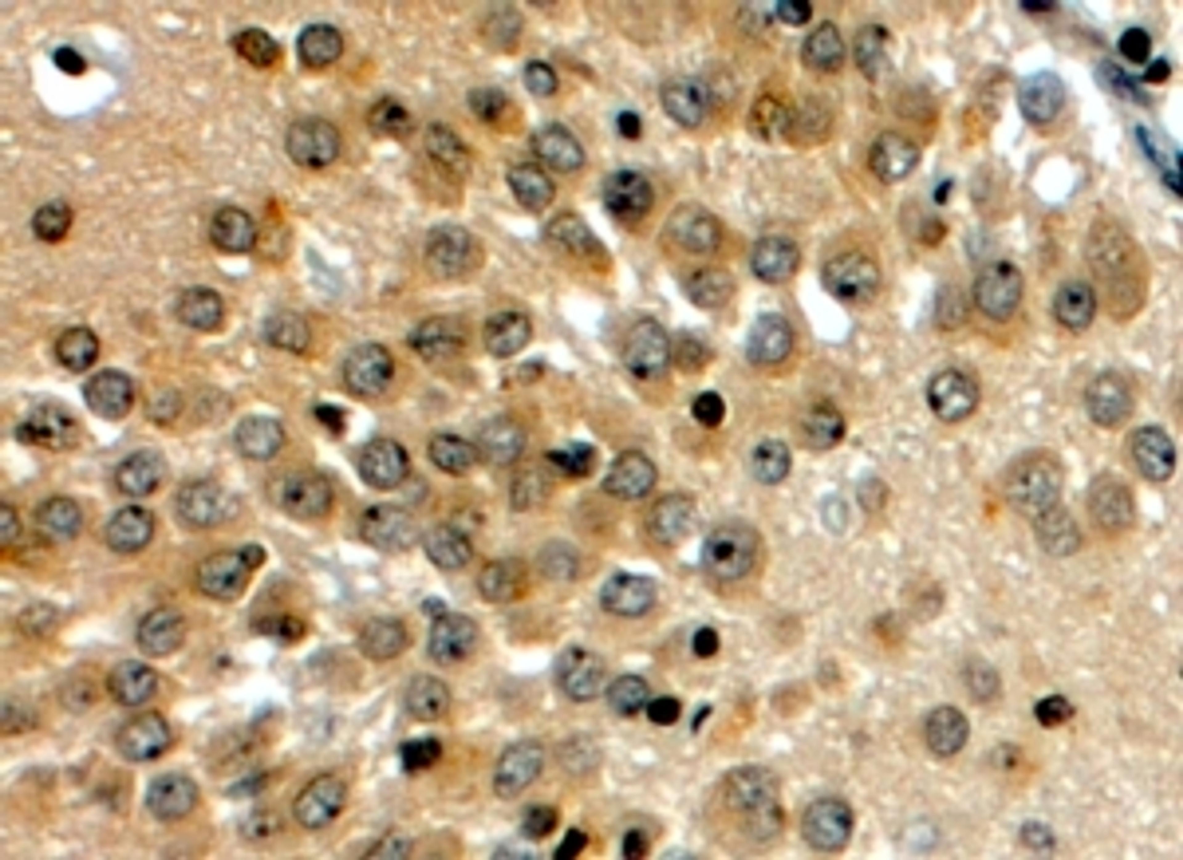 45-978 (4ug/ml) staining of paraffin embedded Human Hippocampus. Steamed antigen retrieval with citrate buffer pH 6, HRP-staining.