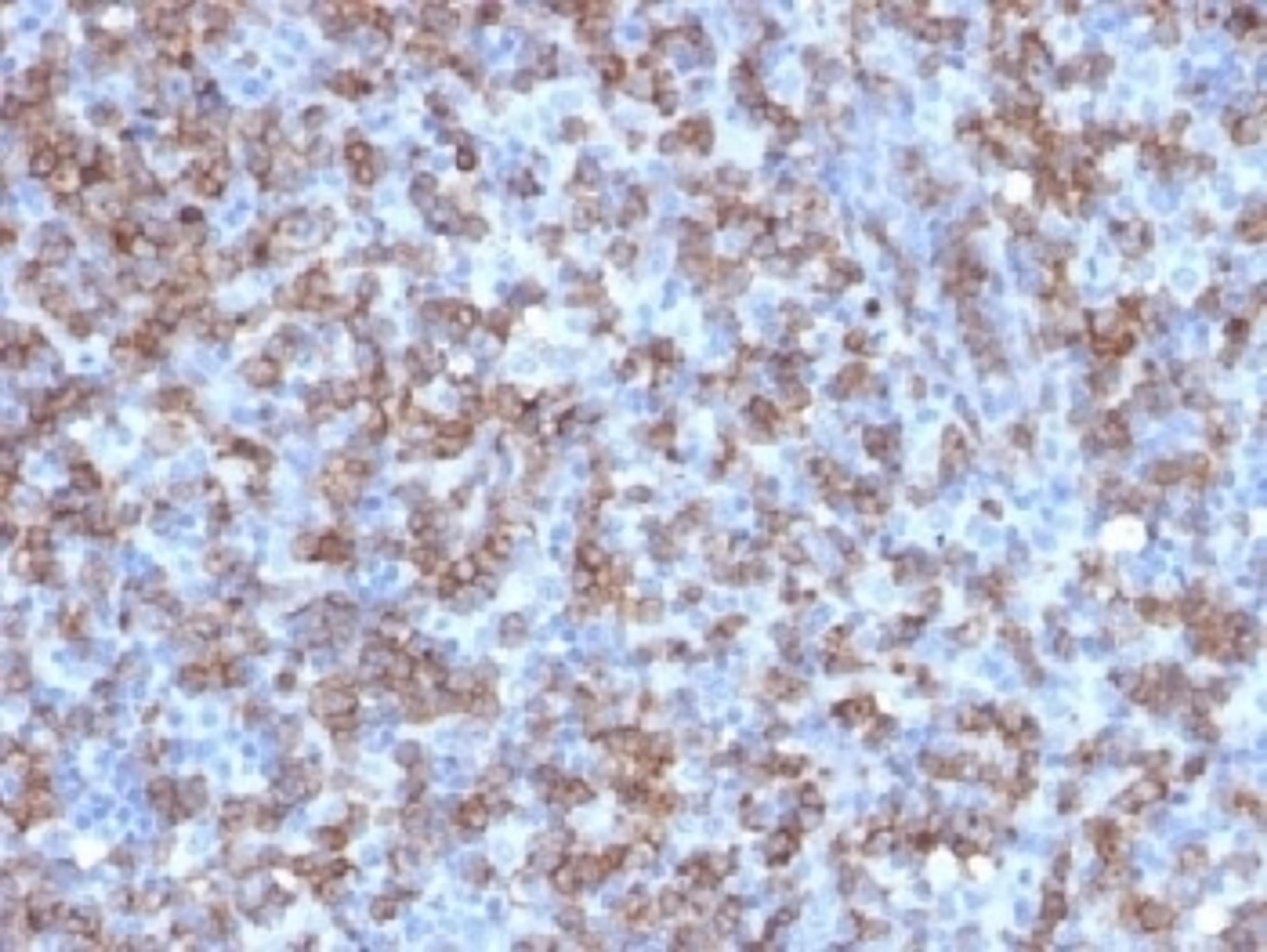 IHC testing of FFPE human tonsil with recombinant CD8 antibody (clone C8/1779R). Required HIER: boil tissue sections in 10mM citrate buffer, pH 6, for 10-20 min followed by cooling at RT for 20 min.