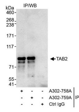 Detection of human TAB2 by western blot of immunoprecipitates.