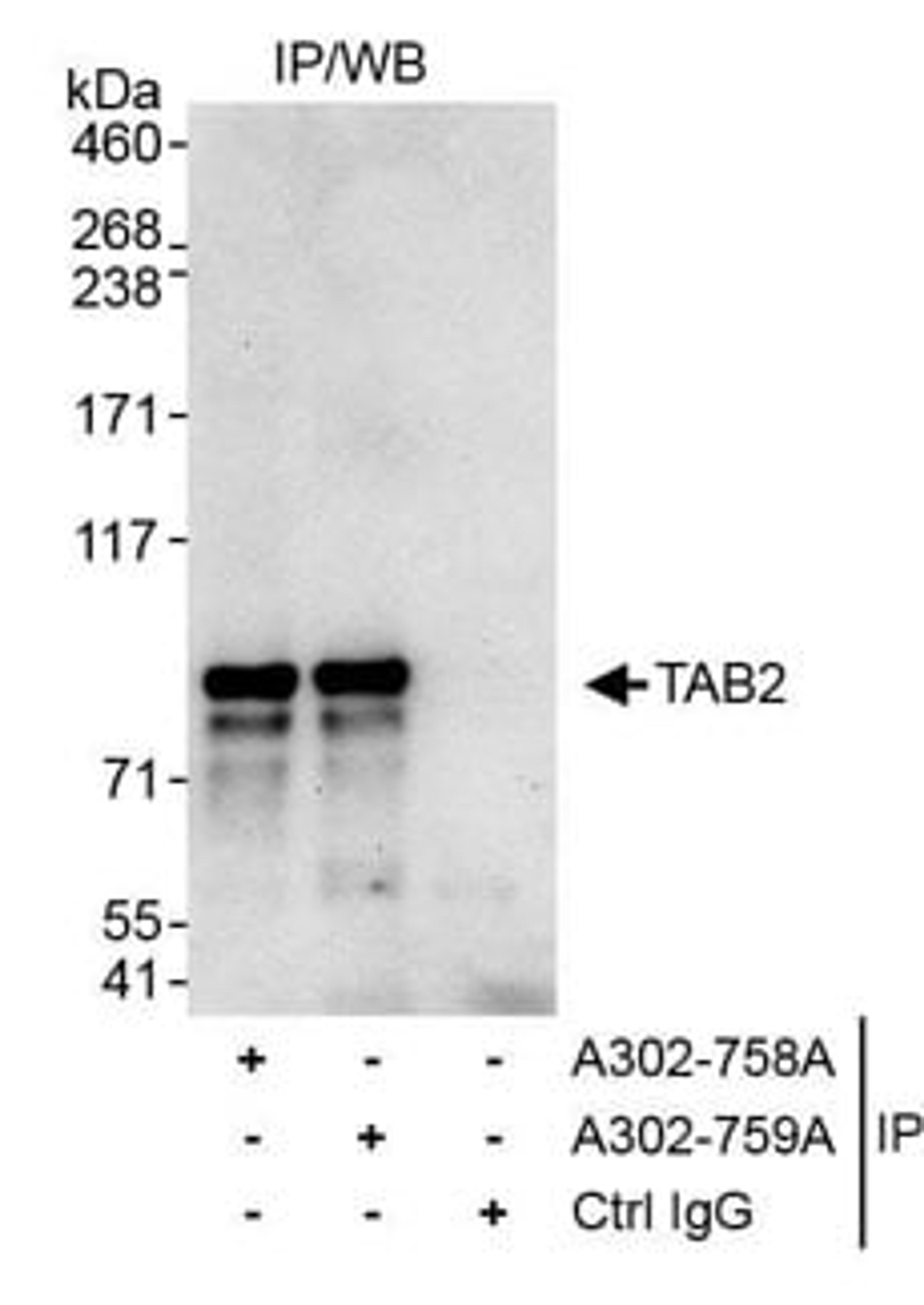 Detection of human TAB2 by western blot of immunoprecipitates.