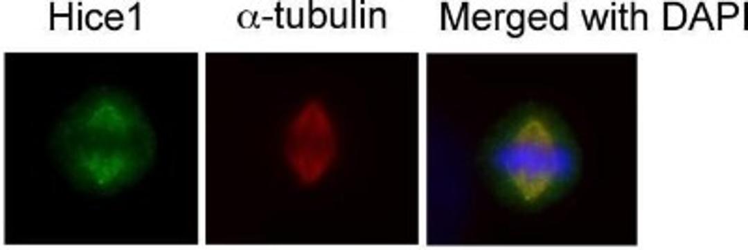 Immunocytochemistry/Immunofluorescence: HAUS8 Antibody [NBP2-42849] - Analysis of human osteosarcoma cell line U2OS, using HICE1 antibody at 1:50-1:200 dilution.